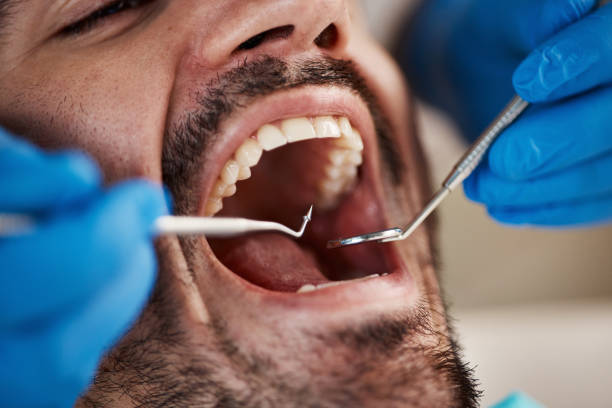 Best Wisdom Tooth Removal  in Ovilla, TX